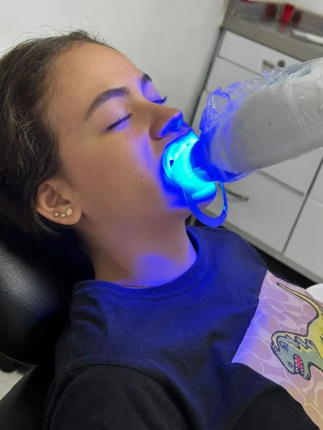 Blanqueamiento dental profesional en Orthodent Ibagué