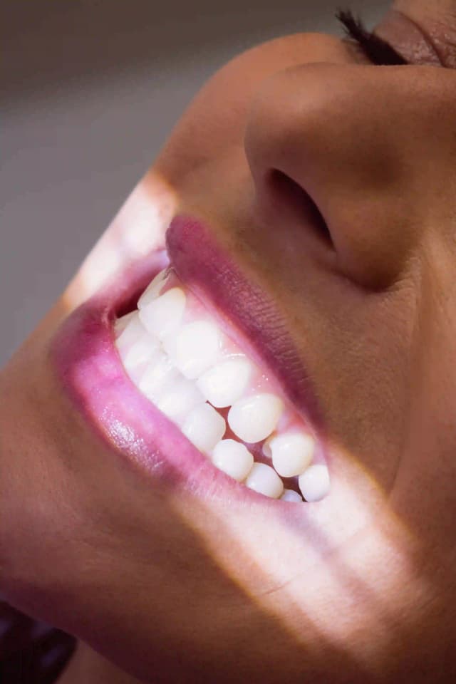 Diseño de sonrisa personalizado en Orthodent Ibagué